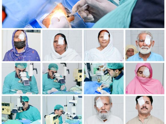 Free Eye Surgeries by Dr. Najam ul Hassan